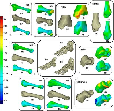 Understanding the form and function in Chinese bound foot from last-generation cases